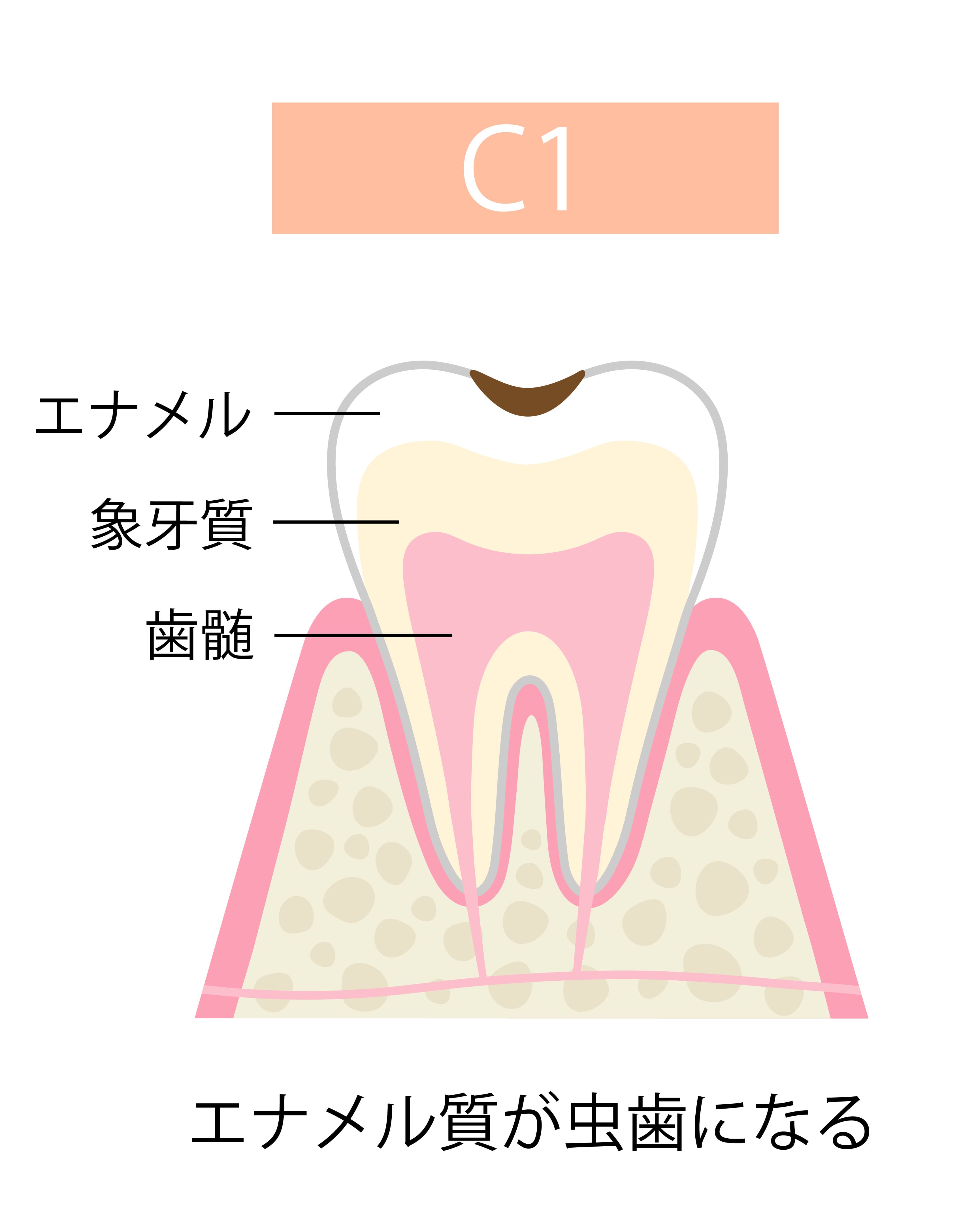 cavity