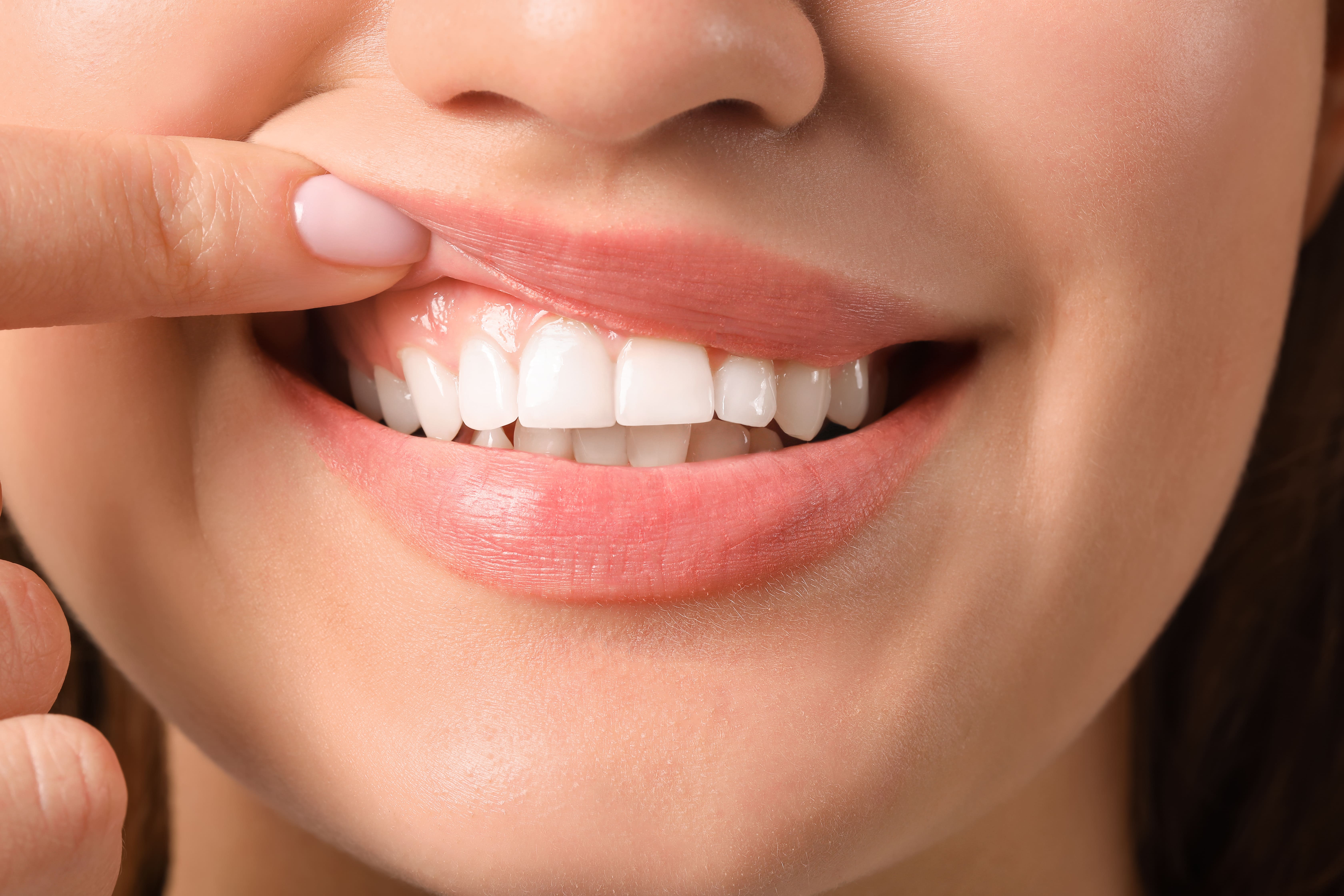 periodontal-disease