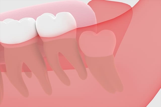 denture