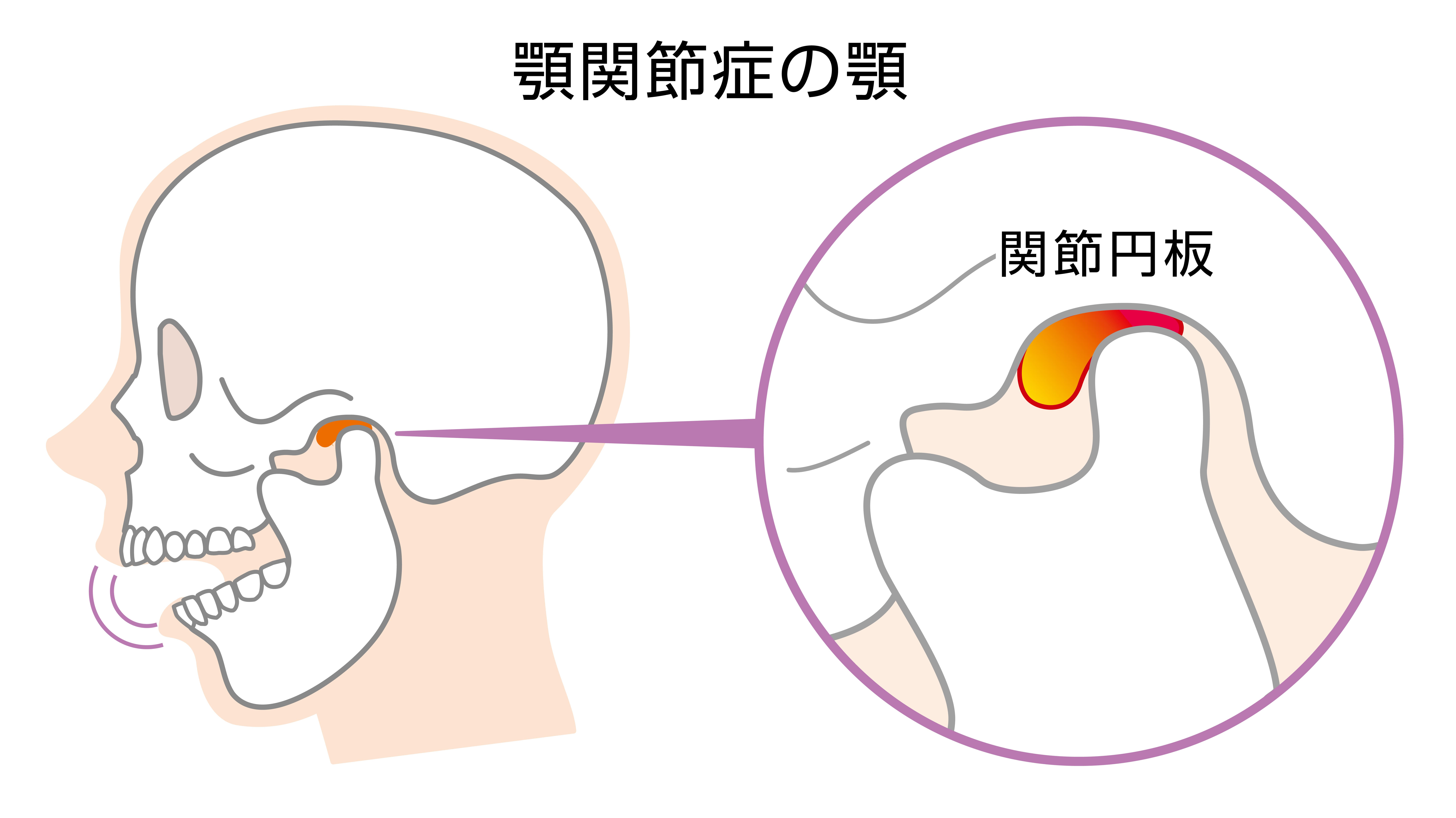 temporomandibular